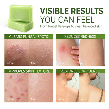 FreshFold™ Cleansing Bar