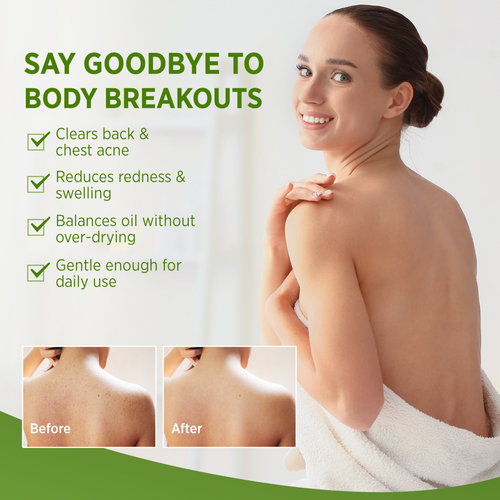 FreshFold™ Cleansing Bar